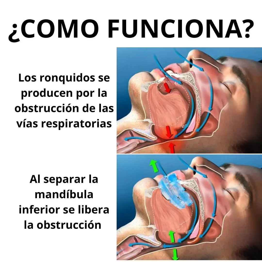 Dispositivo antironquidos y bruxismo+🎁